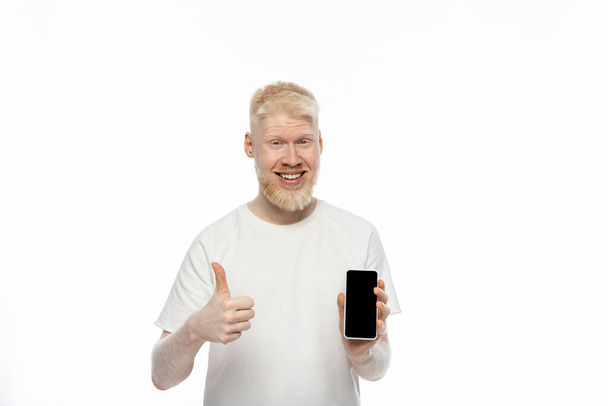 щасливий альбіно чоловік у футболці тримає смартфон з порожнім екраном і показує великий палець вгору ізольовано на білому
  - Фото, зображення