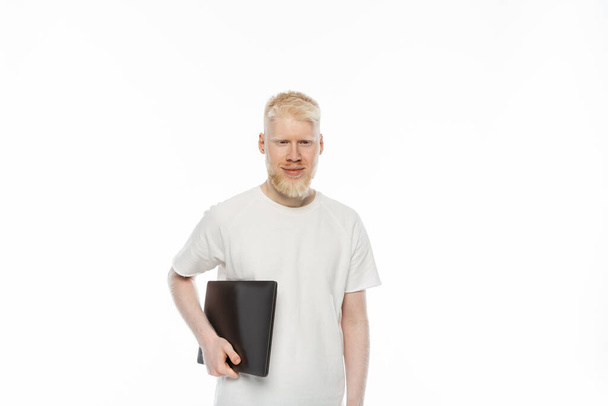 χαρούμενος Albino ελεύθερος επαγγελματίας άνθρωπος σε t-shirt κρατώντας φορητό υπολογιστή που απομονώνονται σε λευκό - Φωτογραφία, εικόνα