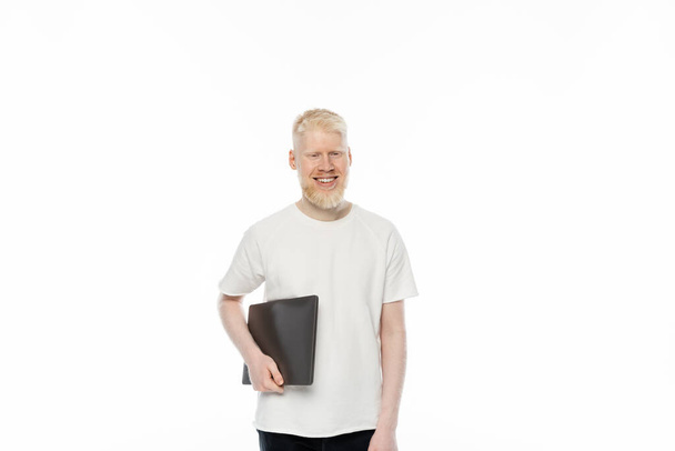 veselý albín na volné noze muž v tričku drží notebook izolované na bílém - Fotografie, Obrázek