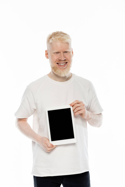 vidám albínó férfi pólóban kezében digitális tabletta üres képernyő elszigetelt fehér - Fotó, kép