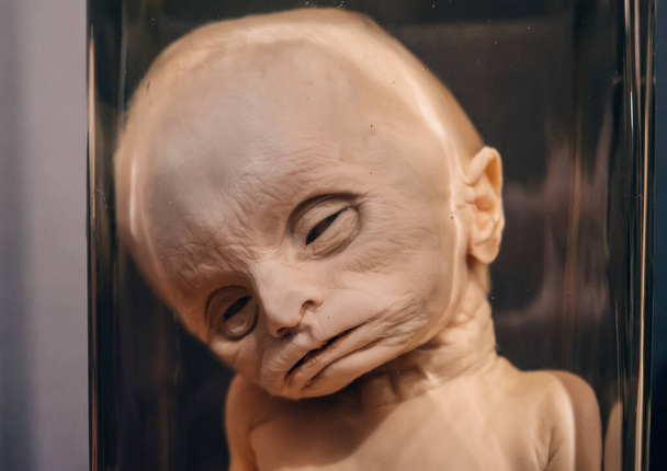 Monster van menselijke foetus met anatomische afwijkingen in potje formaldehyde in rariteitenkabinet close-up. - Foto, afbeelding