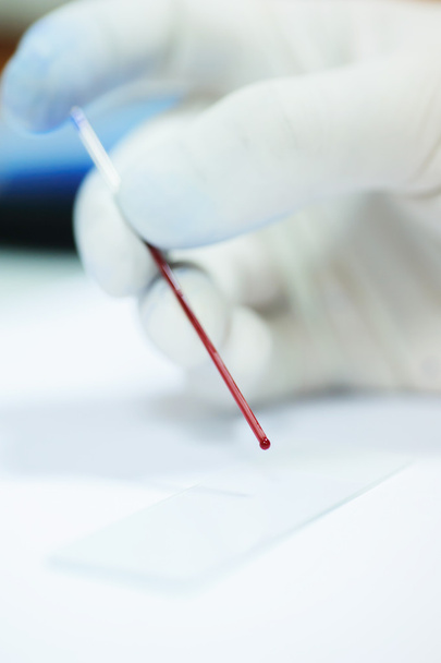 Blood testing in laboratory - Fotografie, Obrázek