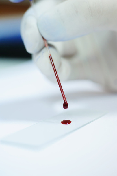 Blood testing in laboratory - Foto, imagen