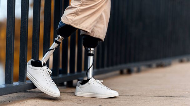 Vue d'un homme avec des jambes prothétiques et des baskets blanches. Reposé un pied sur la clôture - Photo, image
