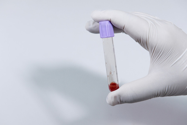 Blood test tube in a laboratory - Fotoğraf, Görsel