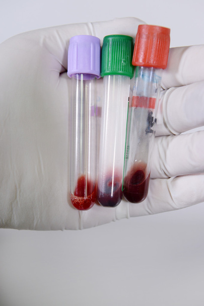 Blood test tube in a laboratory - 写真・画像