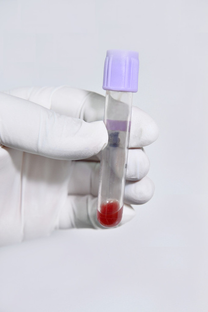 Blood test tube in a laboratory - 写真・画像