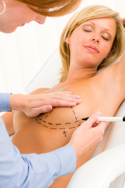 Plastic surgery doctor draw line patient breast - Fotografie, Obrázek