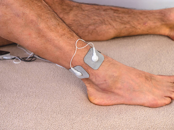 Una persona con elettrodi sulla gamba è un modo efficace per riabilitare, massaggiare o stimolare i muscoli. - Foto, immagini