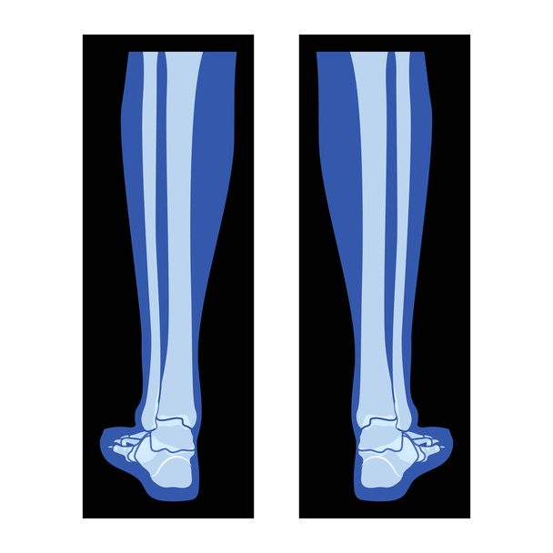 X-Ray Foot Legs Skeleton, Fibula, Tibia - Phalanges Human body, Bones adult people roentgen back view. 3D flat blue color concept Vector illustration of medical anatomy isolated on black background - Vector, Image