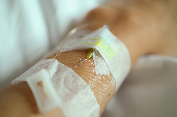 líquido intravenoso para tratar al paciente en el hospital - Foto, imagen