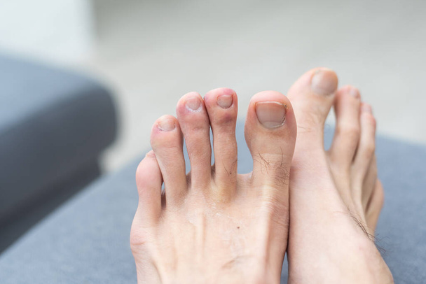 Ordinary Female Feet With Painted Nails. Fetish Stock Photo