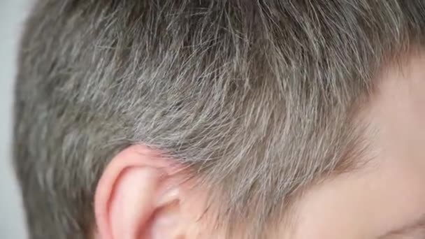 Un hombre de pelo gris muestra canas en sus sienes. El cuidado del cabello, la aparición de canas en los hombres - Imágenes, Vídeo