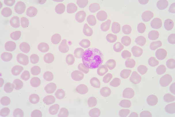 Neutrophil - Fotó, kép