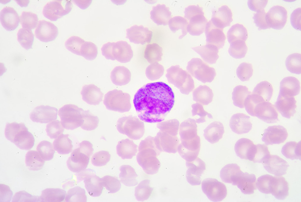 metamyelocyte - Φωτογραφία, εικόνα