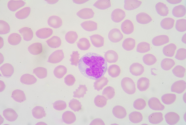 Monocytes
 - Photo, image