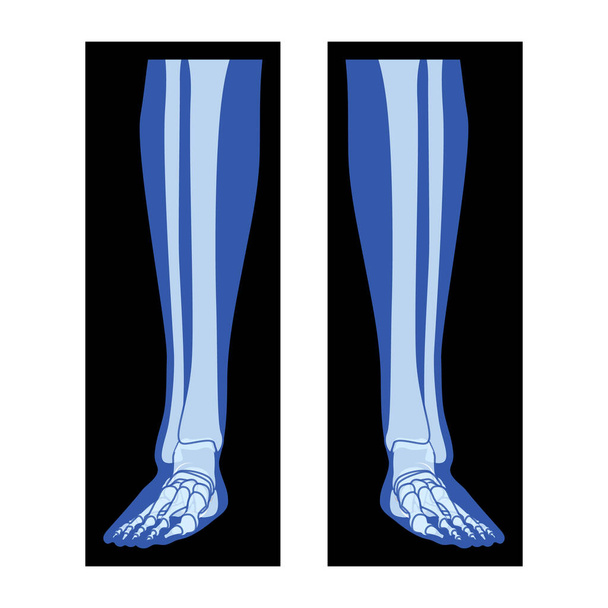 Piernas de pie de rayos X Esqueleto, Fibula, Tibia - Falanges Cuerpo humano, Huesos adultos roentgen vista frontal. Concepto de color azul plano realista 3D Ilustración vectorial de anatomía médica aislada en negro - Vector, imagen