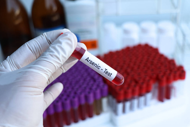 Kan anormallikleri için arsenik testi laboratuvarda analiz edilecek kan örneği, test tüpünde kan. - Fotoğraf, Görsel