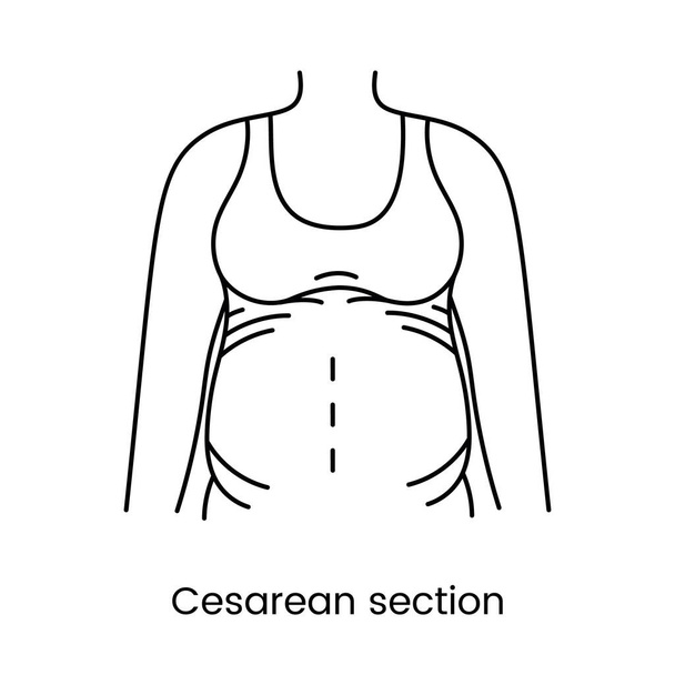 帝王切開は妊娠中の女性のイラストでアイコンラインを表示します - ベクター画像