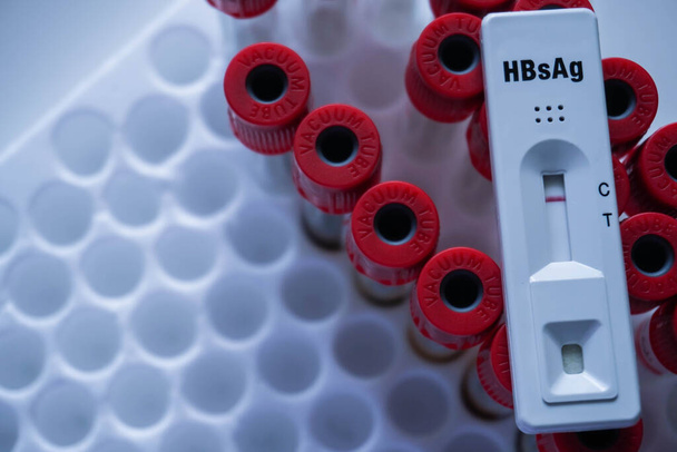 Schnelltest-Kassette für Hepatitis B Virus Test (HBsAg) auf einer roten Vakuumröhre. zeigt ein negatives Ergebnis.Kopierraum - Foto, Bild