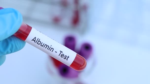 Test d'albumine pour rechercher des anomalies du sang, échantillon de sang à analyser en laboratoire, sang dans une éprouvette - Séquence, vidéo