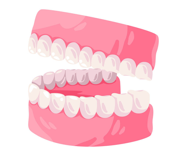 вгору і вниз щелепи ясна рота і зуби ортодонтичні Векторні малюнки ілюстрації
 - Вектор, зображення