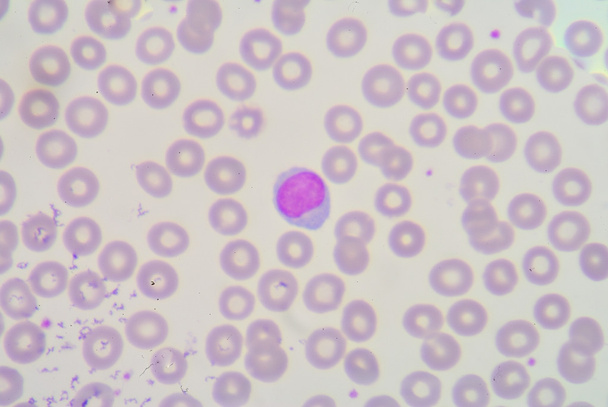 λεμφοκυττάρων - Φωτογραφία, εικόνα