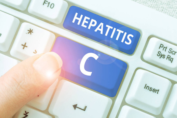 Koncepční titulek Hepatitida C, Business showcase Zánět jater způsobený virovou infekcí Onemocnění jater - Fotografie, Obrázek