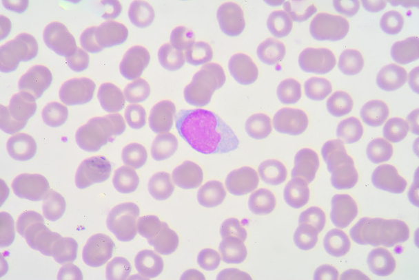 λεμφοκυττάρων - Φωτογραφία, εικόνα