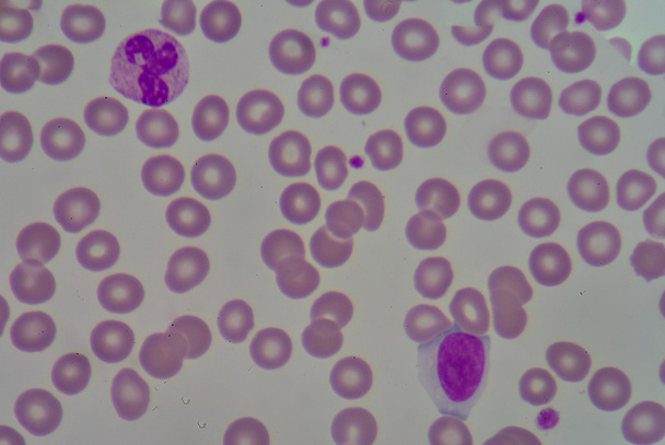 neutrophil&lymphocyte - Photo, Image