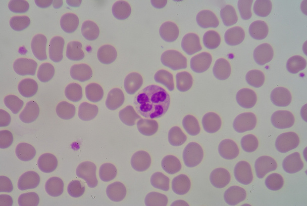Neutrophil - Photo, Image