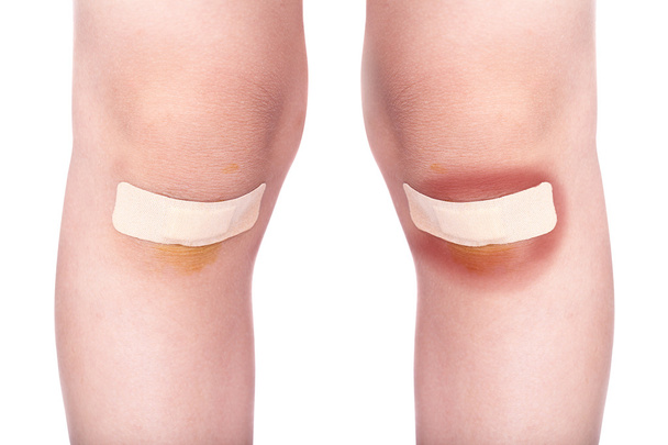 rodillas del niño con un yeso (para heridas) y moretones
 - Foto, Imagen