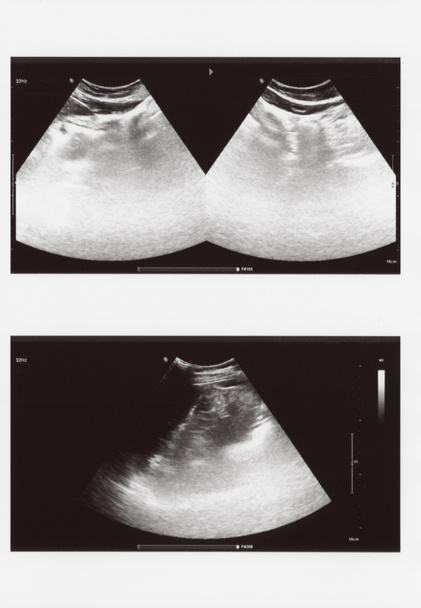 полное ультразвуковое изображение брюшной полости или диагностическая УЗИ - Фото, изображение