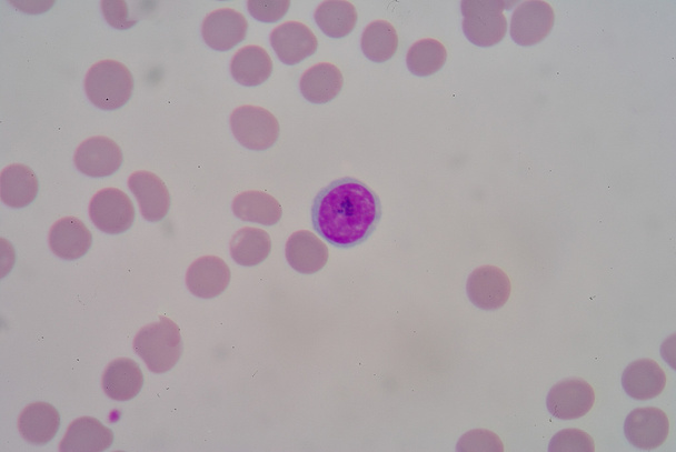 Лимфоциты
 - Фото, изображение