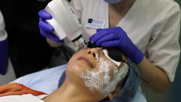 Cara que tiene un tratamiento de la piel del laser, una técnica del resurfacing para las arrugas - Imágenes, Vídeo