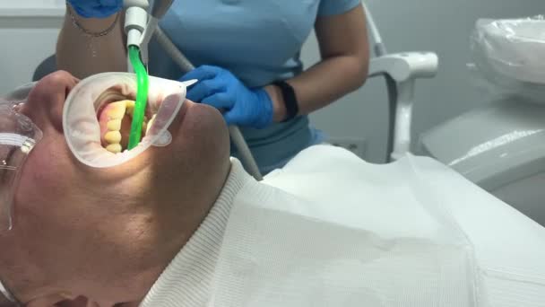 zbliżenie w klinice stomatologicznej można zobaczyć Jak zęby są myte i wyrzutnik śliny wysysa nadmiar wody człowiek w swetrze otworzył usta nosi gogle w celu ochrony przed uzyskaniem czyszczenia zębów  - Materiał filmowy, wideo