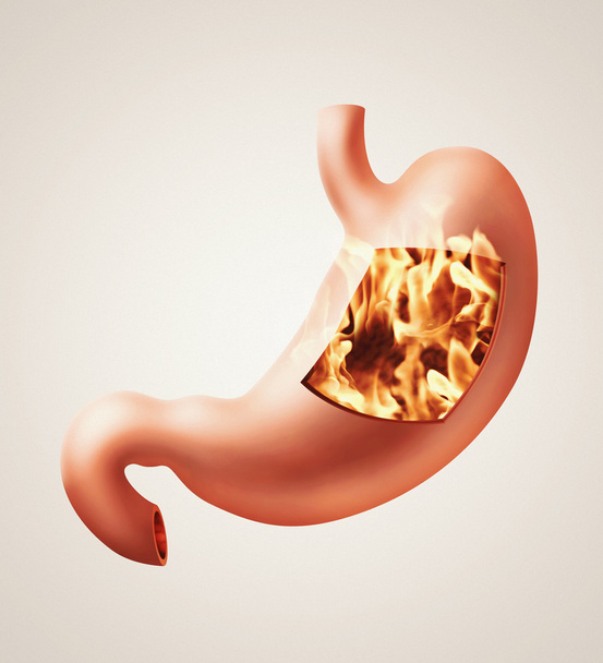 胃胸焼けコンセプト - 写真・画像