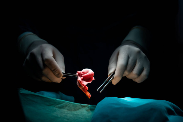 Χειρουργική ομάδα που εκτελεί χειρουργική επέμβαση σε ασθενή σε αποστειρωμένο χειρουργείο. Σε μια χειρουργική αίθουσα αναμμένη με λάμπα, μια επαγγελματική και σίγουρη χειρουργική ομάδα παρέχει ιατρική φροντίδα σε αναίσθητο ασθενή. - Φωτογραφία, εικόνα