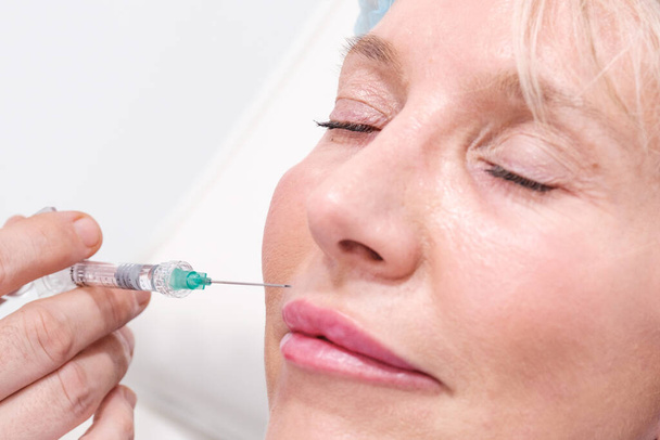 Close up picture of lips taking hyaluronic acid injections and Botox in an aesthetic clinic. Non-surgical treatment to reduce wrinkles and avoid aging. Copy space for titles and white background - Foto, Bild