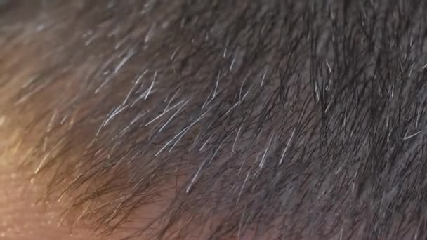 Close-up of problem hair with gray hair. Consequences of stress and fatigue at work. Gray hair at an early age - Felvétel, videó