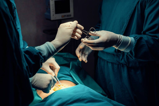 Beeld van chirurgische team voeren chirurgische ingreep, verpleegkundige uitdelen steriele schaar aan chirurg als ondersteunende en coöperatieve in operatiekamer concept. - Foto, afbeelding