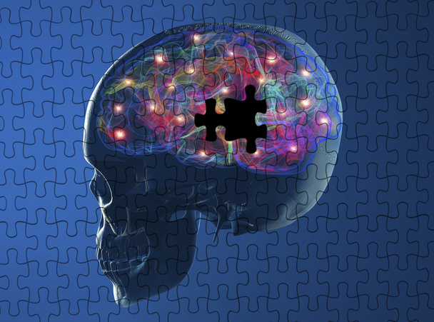Doenças degenerativas cerebrais Parkinson
 - Foto, Imagem
