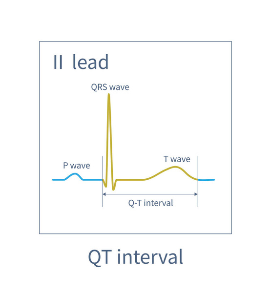 The QT interval of ECG is from the beginning of QRS wave to the end of T wave, representing the total time of ventricular depolarization and repolarization. - Fotoğraf, Görsel
