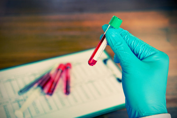 臨床研究室での血液サンプル製造・検査・研究用チューブを保持する科学者のヴィンテージトーン - 写真・画像