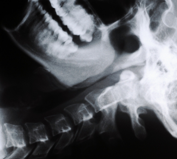 radiografia del collo umano
 - Foto, immagini