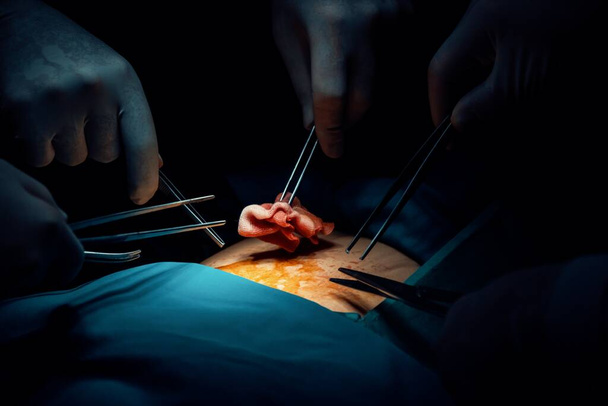 Closeup chirurgische team het uitvoeren van een operatie aan de patiënt in steriele operatiekamer. In een operatiekamer verlicht door een lamp, een professionele en zelfverzekerde chirurgische team biedt medische zorg aan bewusteloze patiënt. - Foto, afbeelding
