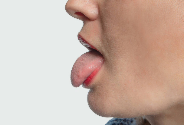 Side view of woman's face with her tongue sticking out. Treatment of ENT diseases. - Foto, Imagem