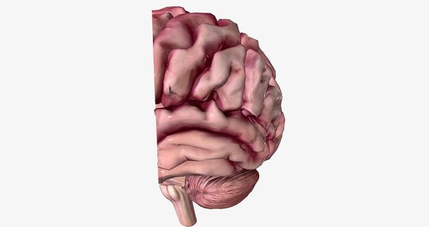 Alzheimer's Disease Brain Cross Section 3D rendering - 写真・画像