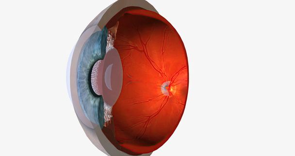 Higher than normal intraocular pressure in the absence of ocular hypertension, optic nerve damage, or visual field loss 3D rendering - Фото, изображение