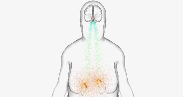 The Cushing Sendrom, Pituitary Adenoma 3D rendering - Фото, зображення